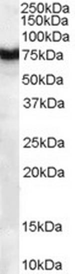 FZD8 Antibody in Western Blot (WB)