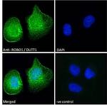 ROBO1 Antibody in Immunocytochemistry (ICC/IF)