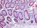 SCD Antibody in Immunohistochemistry (Paraffin) (IHC (P))