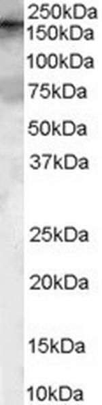 GEF5 Antibody in Western Blot (WB)