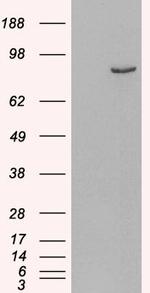 PDE4B Antibody in Western Blot (WB)