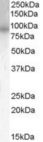 PDE4B Antibody in Western Blot (WB)