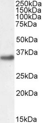 EN2 Antibody in Western Blot (WB)