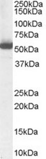 ALDH1A1 Antibody in Western Blot (WB)