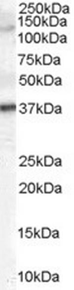 GALR3 Antibody in Western Blot (WB)