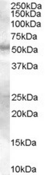 SMAD9 Antibody in Western Blot (WB)