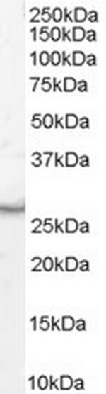 VTI1B Polyclonal Antibody