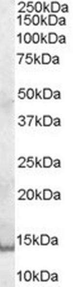 GCDFP-15 Antibody in Western Blot (WB)