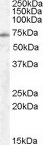 EXOC7 Antibody in Western Blot (WB)