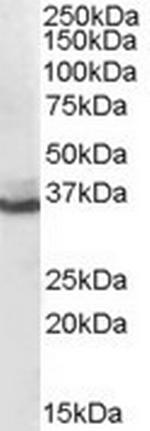 AKR1C4 Antibody in Western Blot (WB)