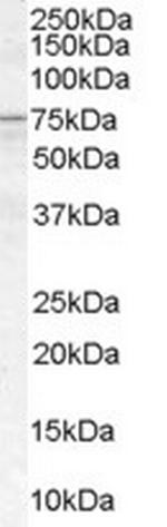 ACSL5 Antibody in Western Blot (WB)