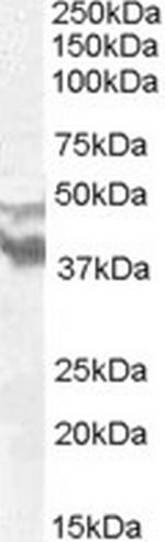 DYX1C1 Polyclonal Antibody