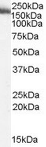 MYO9B Polyclonal Antibody
