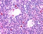 AIRE Antibody in Immunohistochemistry (Paraffin) (IHC (P))
