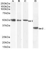Chromogranin A Precursor Polyclonal Antibody