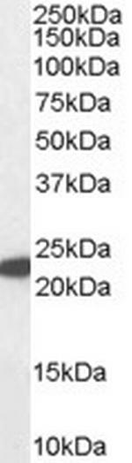 GPX1 Antibody in Western Blot (WB)