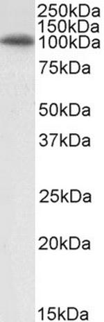 GRP94 Antibody in Western Blot (WB)