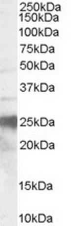 PrP Polyclonal Antibody