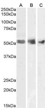 WT1 Polyclonal Antibody