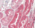 VHL Antibody in Immunohistochemistry (Paraffin) (IHC (P))