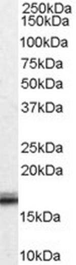 VHL Antibody in Western Blot (WB)