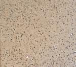 GBX2 Antibody in Immunohistochemistry (Paraffin) (IHC (P))