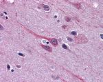 GBX2 Antibody in Immunohistochemistry (Paraffin) (IHC (P))