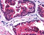 SNX26 Antibody in Immunohistochemistry (Paraffin) (IHC (P))