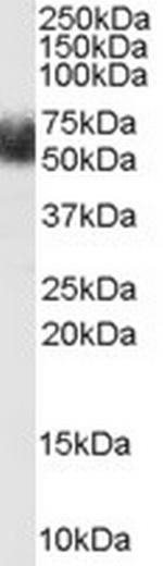 FBXL3 Antibody in Western Blot (WB)
