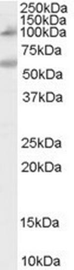 NOD2 Polyclonal Antibody