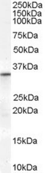 VDAC2 Polyclonal Antibody