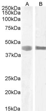 Septin 1 Antibody in Western Blot (WB)