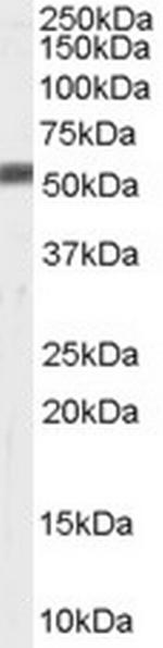 ZMPSTE24 Polyclonal Antibody
