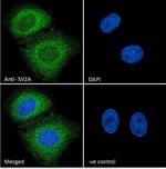 SV2A Polyclonal Antibody