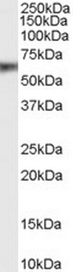 EphB2 Polyclonal Antibody