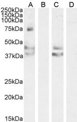 AGTR1 Polyclonal Antibody