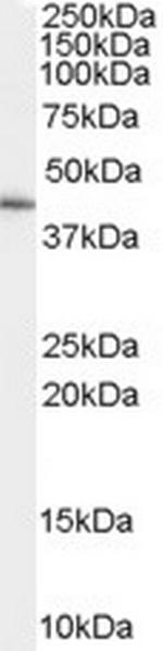 GATA5 Polyclonal Antibody