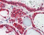 LPIN3 Polyclonal Antibody