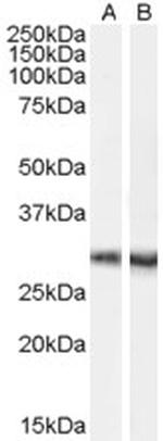 DCDC2 Polyclonal Antibody