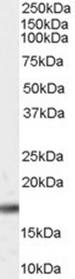 PIN1 Polyclonal Antibody