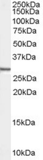 Syntenin 1 Antibody in Western Blot (WB)