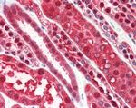 PEBP1 Antibody in Immunohistochemistry (Paraffin) (IHC (P))