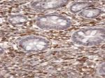 S100A4 Antibody in Immunohistochemistry (Paraffin) (IHC (P))