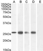 Connexin 26 Antibody in Western Blot (WB)