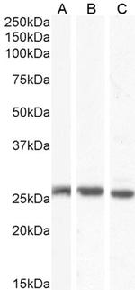 Connexin 26 Antibody in Western Blot (WB)