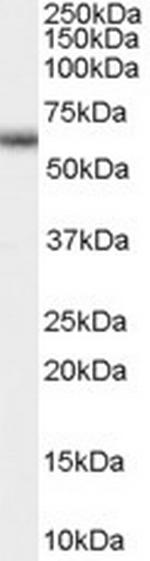 GnRHR Polyclonal Antibody