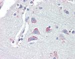 CRHR1 Antibody in Immunohistochemistry (Paraffin) (IHC (P))