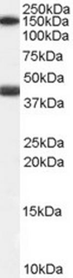 GALR1 Polyclonal Antibody