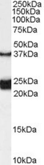 GALR1 Antibody in Western Blot (WB)