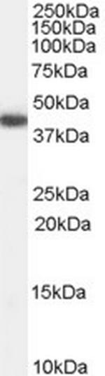 GALR2 Polyclonal Antibody